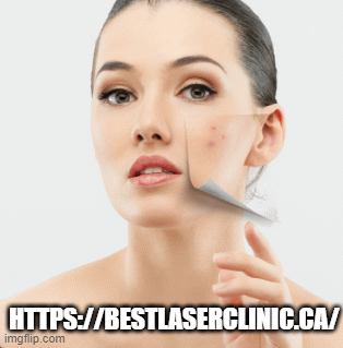 bestlaserclinic447318324be2e30c.gif