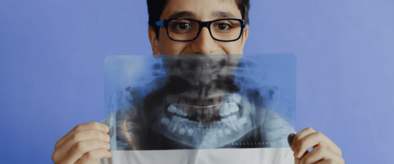 umRx6.png